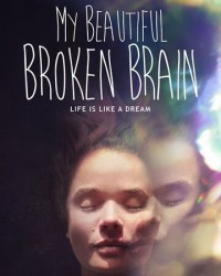 Xem phim Khối óc xinh đẹp tội nghiệp của tôi - My Beautiful Broken Brain (2016)